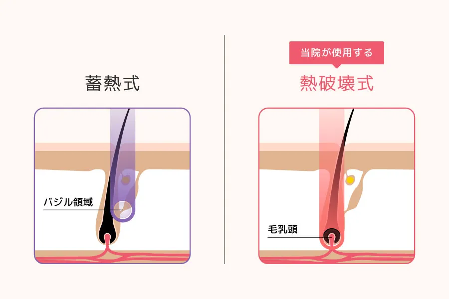 蓄熱式と熱破壊式の比較