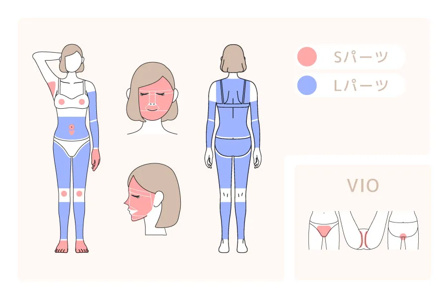セレクトVIOとセレクト7の参考画像